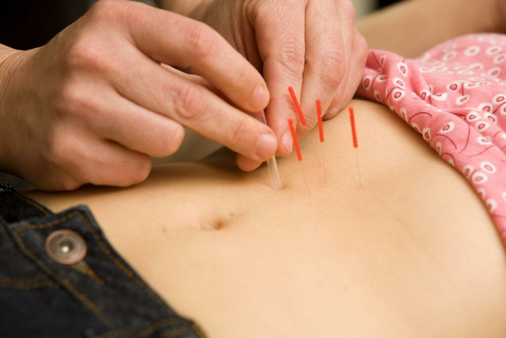 acupuncture for infertility