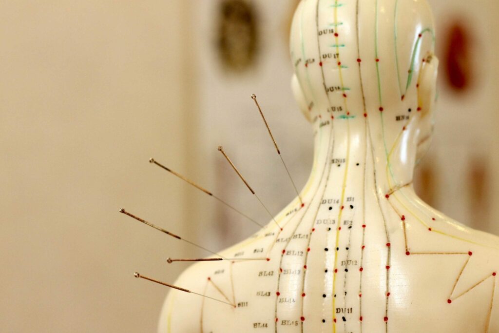Acupuncture chart with meridians