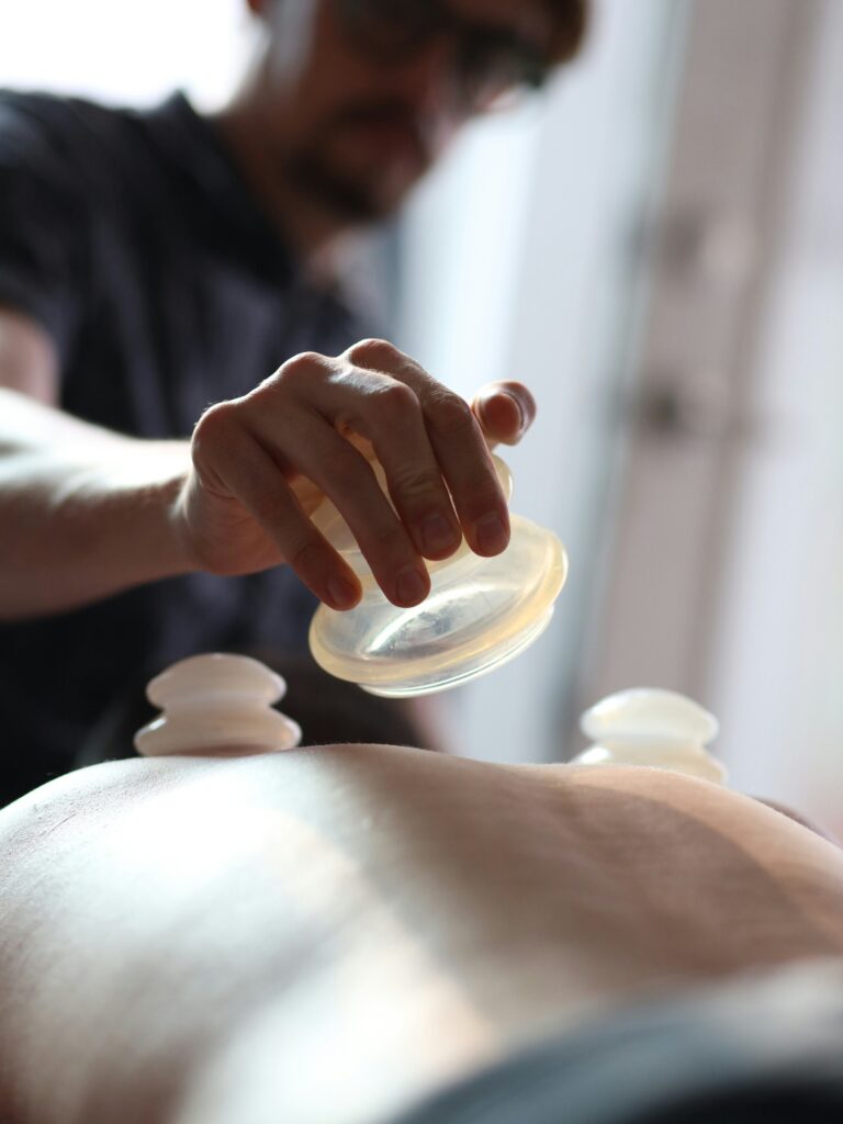 a practitioner placing silicon cups on a patient for a traditional Chinese medicine cupping treatment